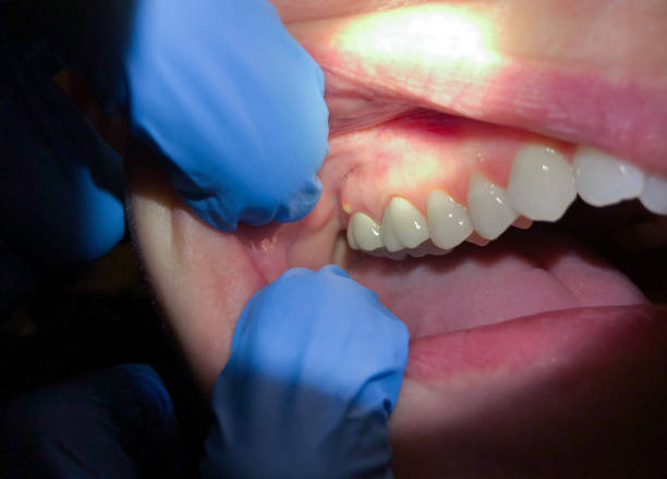 Best Tooth Infection Emergency Dentist  in Fort Riley, KS