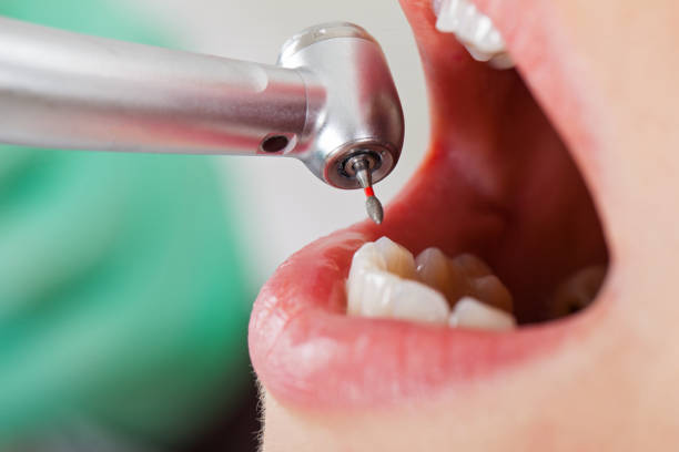Best Urgent Tooth Repair  in Fort Riley, KS